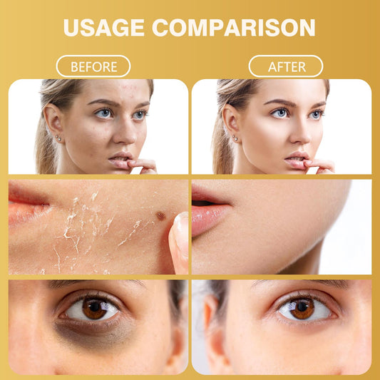 Bee Venom Skin Treatment Cream - Anti Aging Moisturizer with Collagen Boost & Skin Brightening, Bee Venom Sensitive Skin Tightening Care Day & Night Use 2.12 OZ - GLOWLAB
