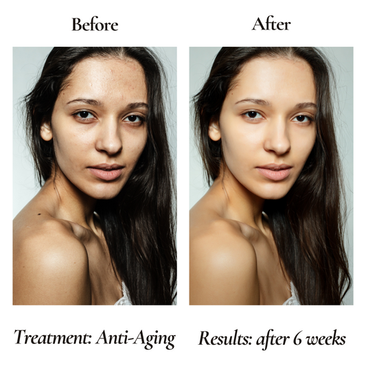 Anti-Aging Organic Facial Moisturizer - FOR WOMEN - GLOWLAB