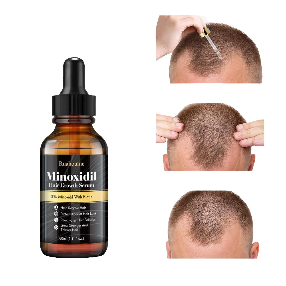 2-Pack 5% Minoxidil Hair Growth Serum, Hair Regrowth Treatment for Men and Women, Strengthens and Thickens Hair for Fuller, Longer Results, Beard and Facial Hair Enhancer - GLOWLAB